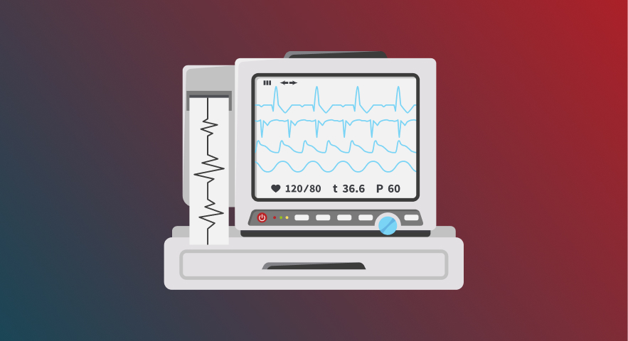 Hypertrophic Cardiomyopathy