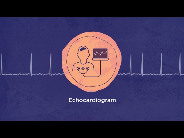 Graphic with an echocardiogram reading pattern, with a circle in front including an icon of an individual connected to an echocardiogram machine and chart.